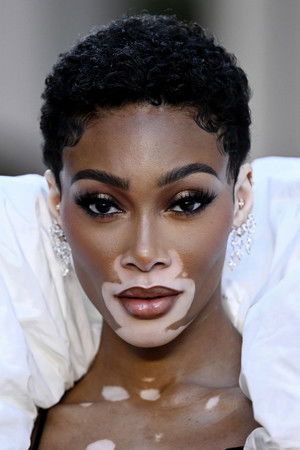 Winnie Harlow profil kép