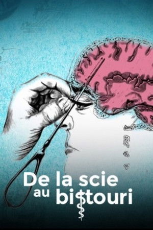 De la scie au bistouri