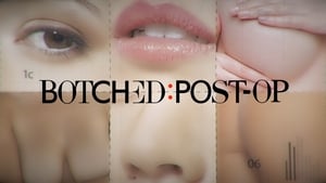 Botched: Post Op kép