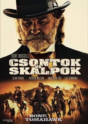 Csontok és skalpok