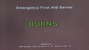 Emergency First Aid Series: Burns háttérkép