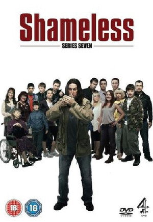 Shameless