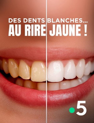 Des dents blanches... au rire jaune ! poszter