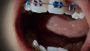 Open Wide háttérkép