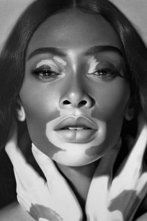 Winnie Harlow profil kép