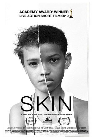 Skin poszter