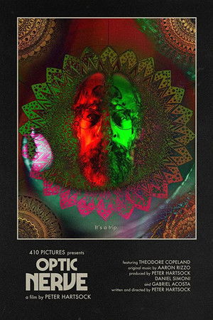 Optic Nerve