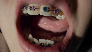 Open Wide háttérkép