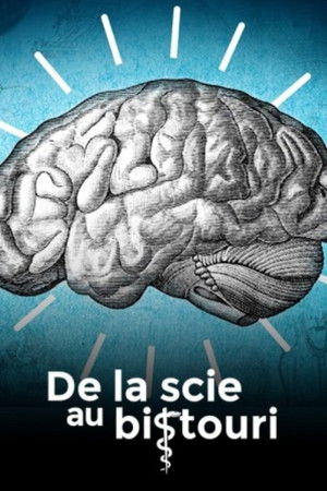 De la scie au bistouri