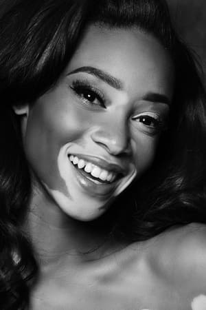 Winnie Harlow profil kép