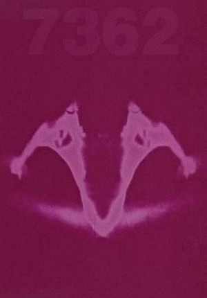 7362 poszter