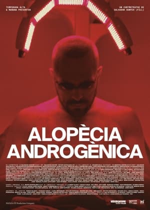 Alopècia androgènica