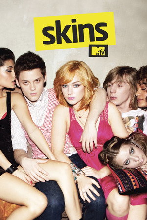 Skins (US)
