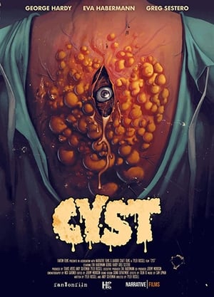 Cyst poszter